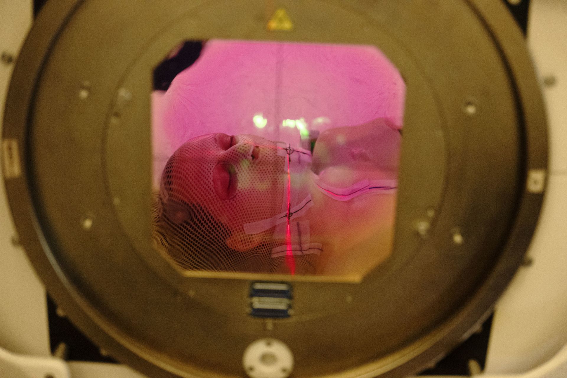 De foto van een patiënte tijdens de bestralingstherapie illustreert de medische context van de dradenkruisen